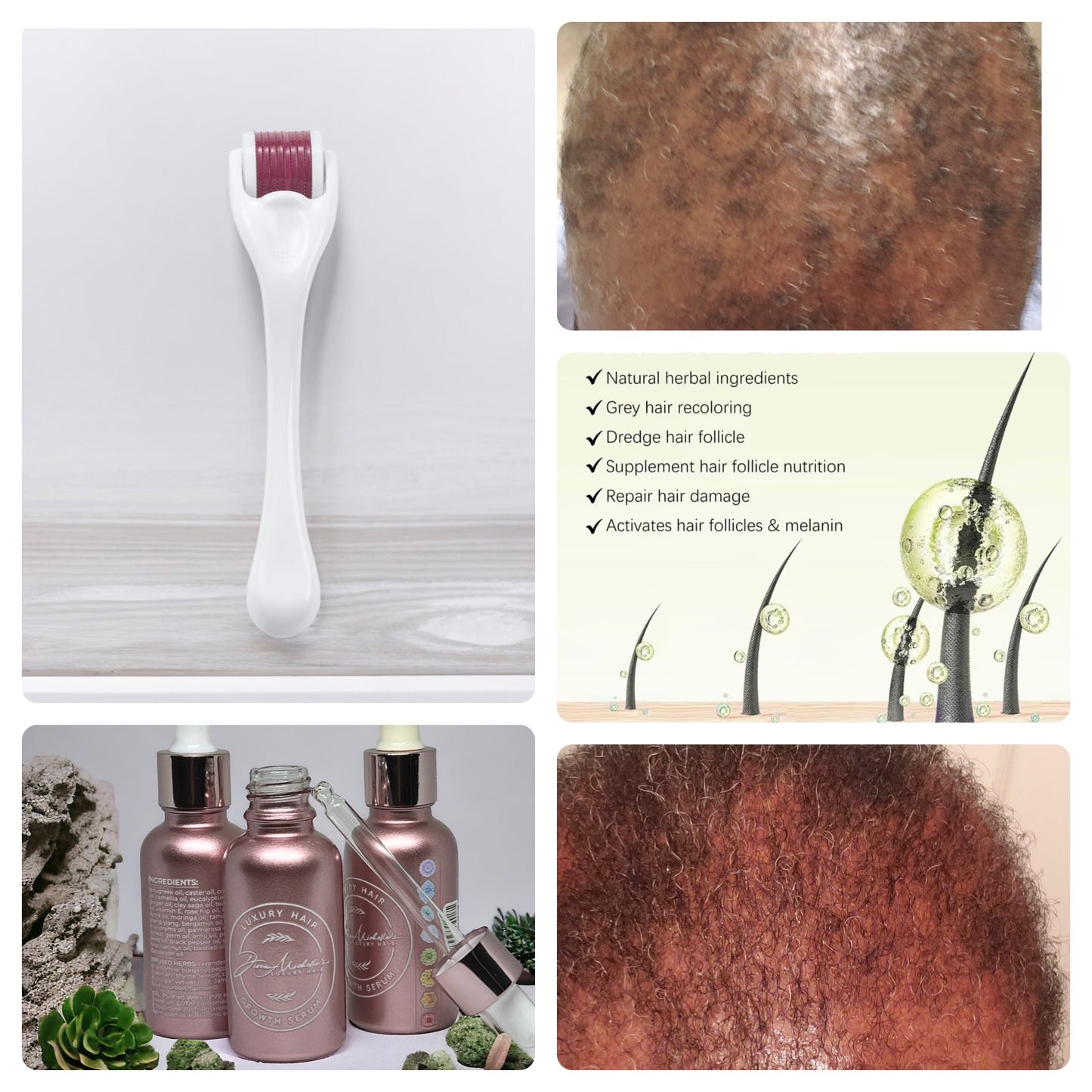 Hippie Feather's Micro Derma Needle Therapy Roller