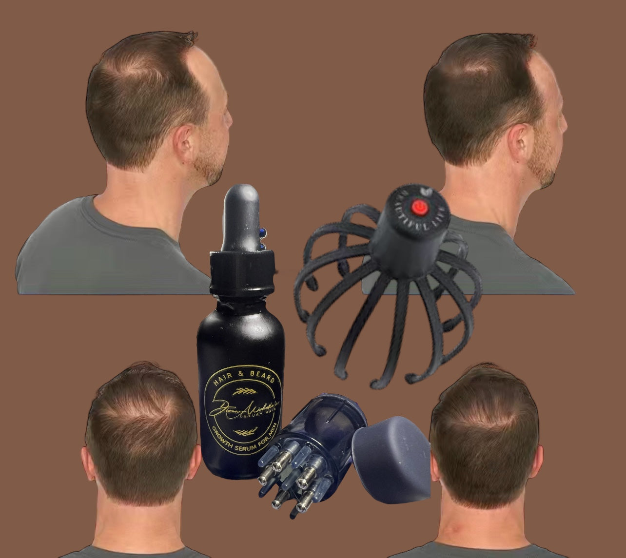 222 Black Laser Red Light Scalp StimulationTherapy Claw For Men